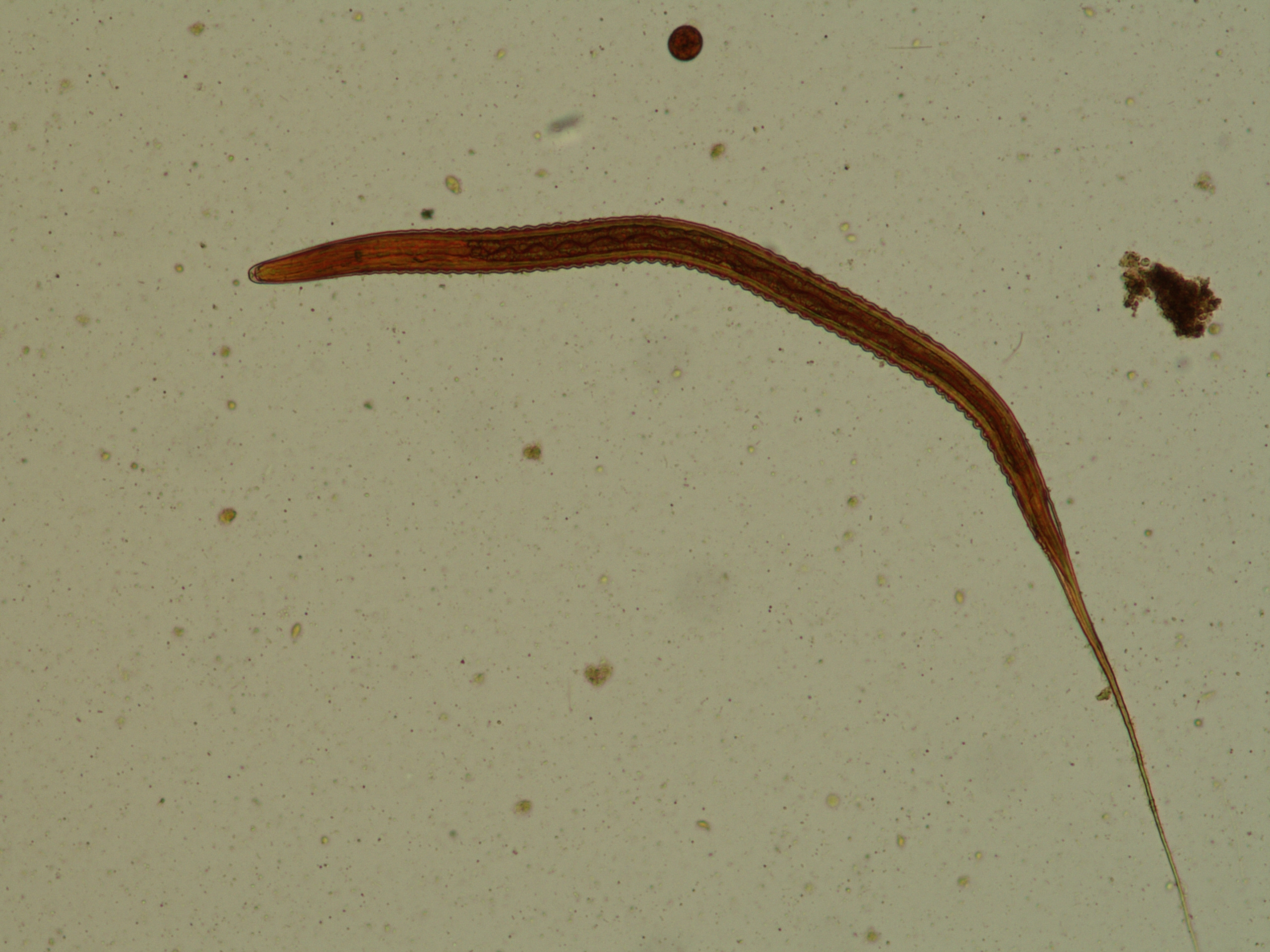 Larva tercer estadio de Strongylus vulgaris
